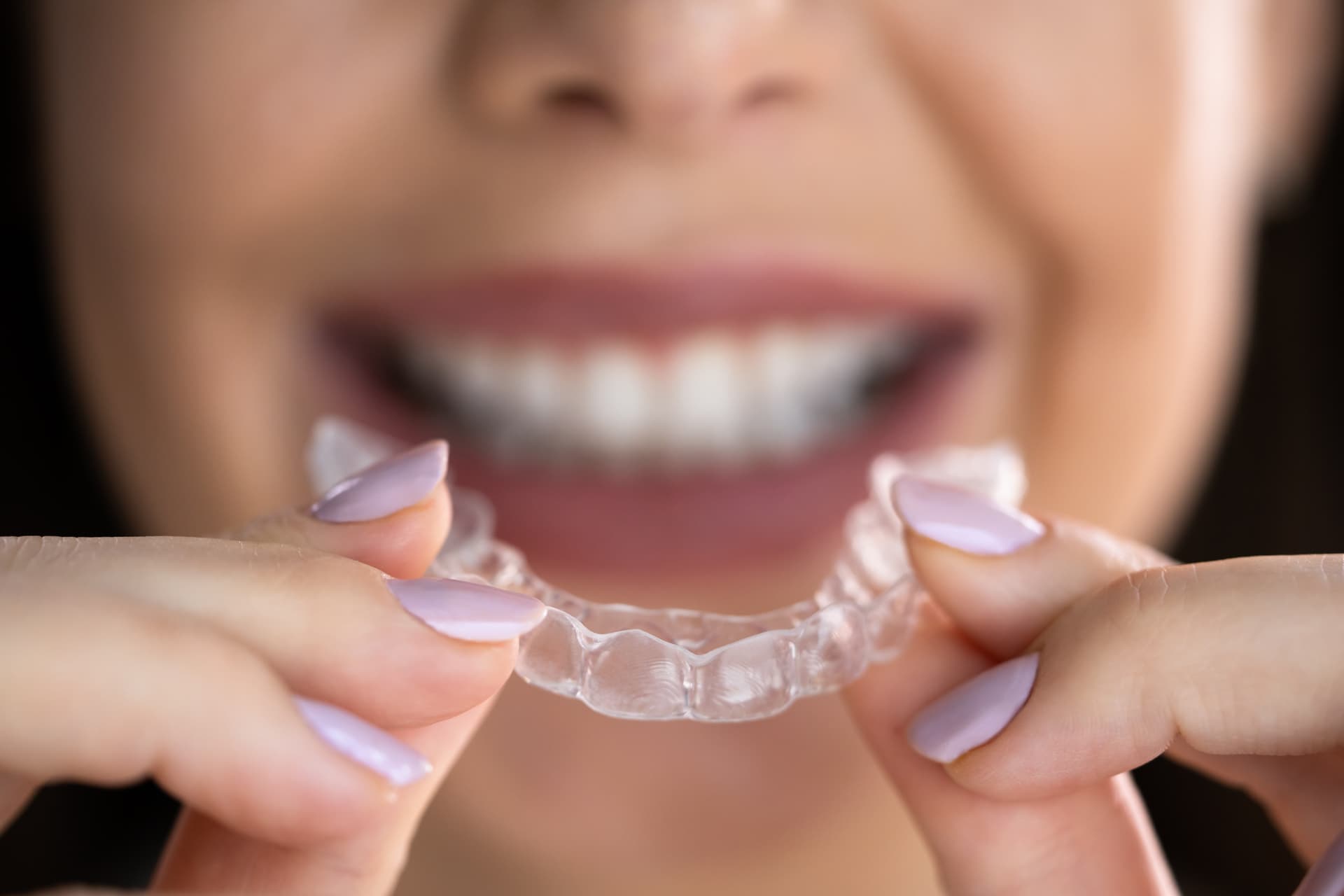 Invisalign