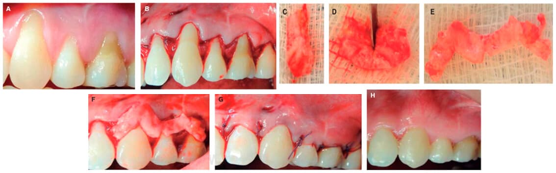 Clínica dental en Vigo