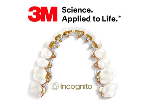 Tratamientos Invisalign en vigo