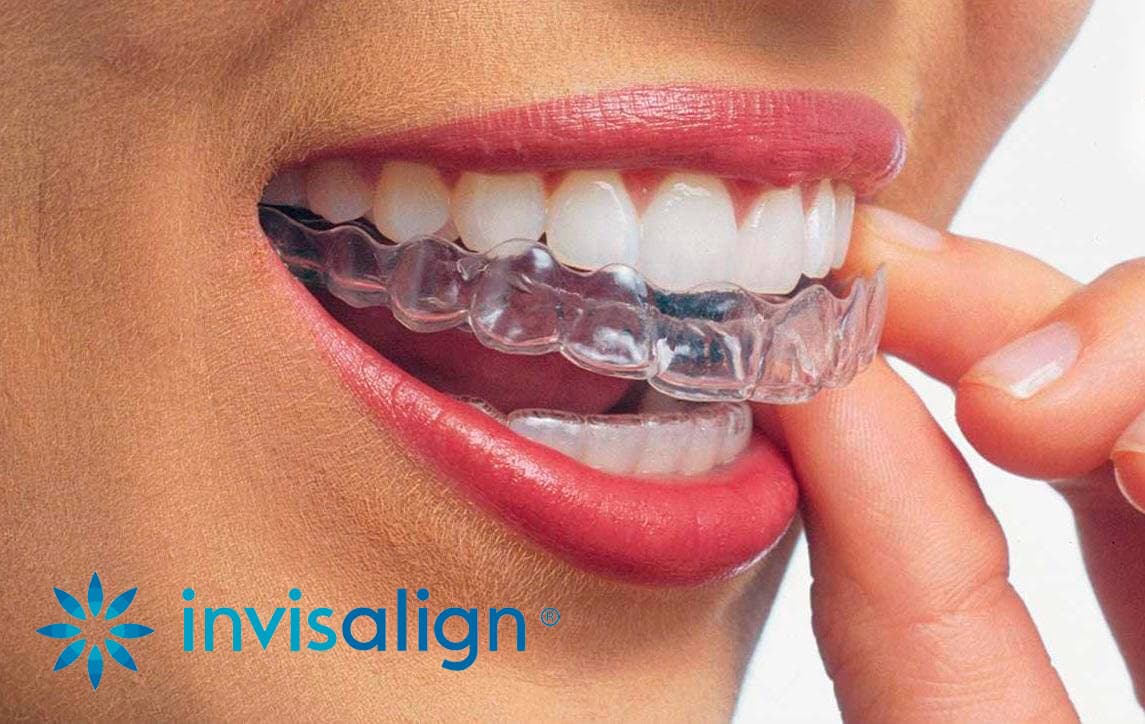   Tratamientos de cirugía oral y maxilofacial integrales en Vigo